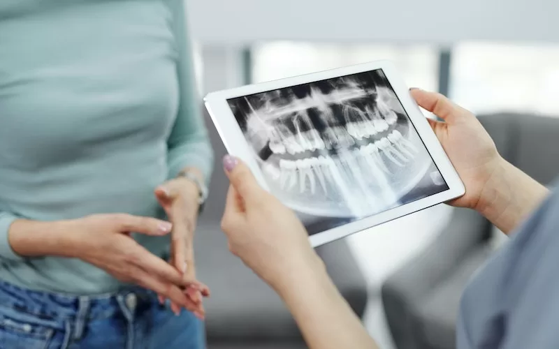 dental implant cost perth