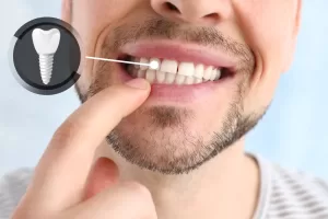 dental implant healing stages