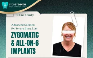 FROM 20 YEARS OF DENTURES TO A RADIANT NEW ZEALAND SMILE - SYDNEY TOP DENTAL