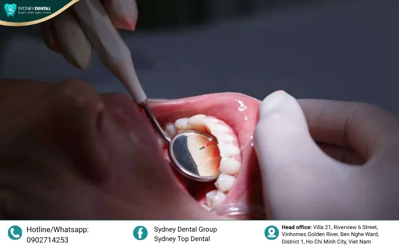 Advanced tools like water flossers and electric toothbrushes remove bone-destroying bacteria more effectively.