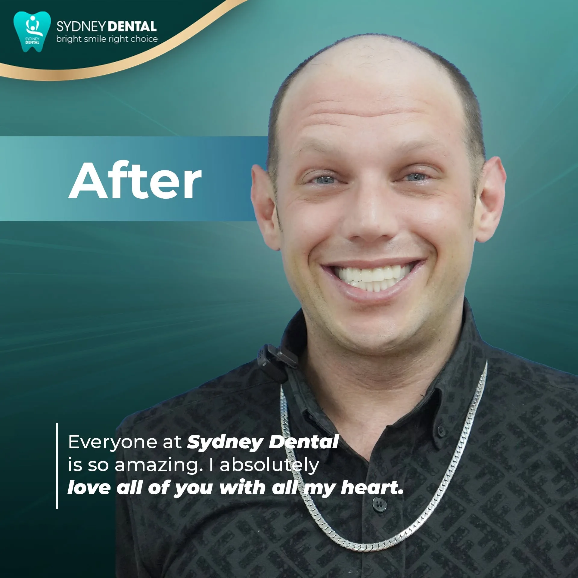 Adam smiling confidently and looking radiant after his dental transformation at Sydney Top Dental, highlighting his emotional joy and renewed youthfulness.