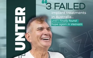 Reclaiming A Smile After 3 Failed Implant Treatments In Australia: Axal The Success Story At Sydney Top Dental