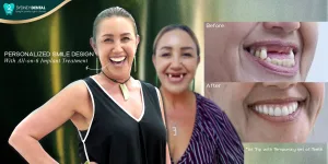 Ending the Journey of Compromise: Eva’s Transformation with All-on-6