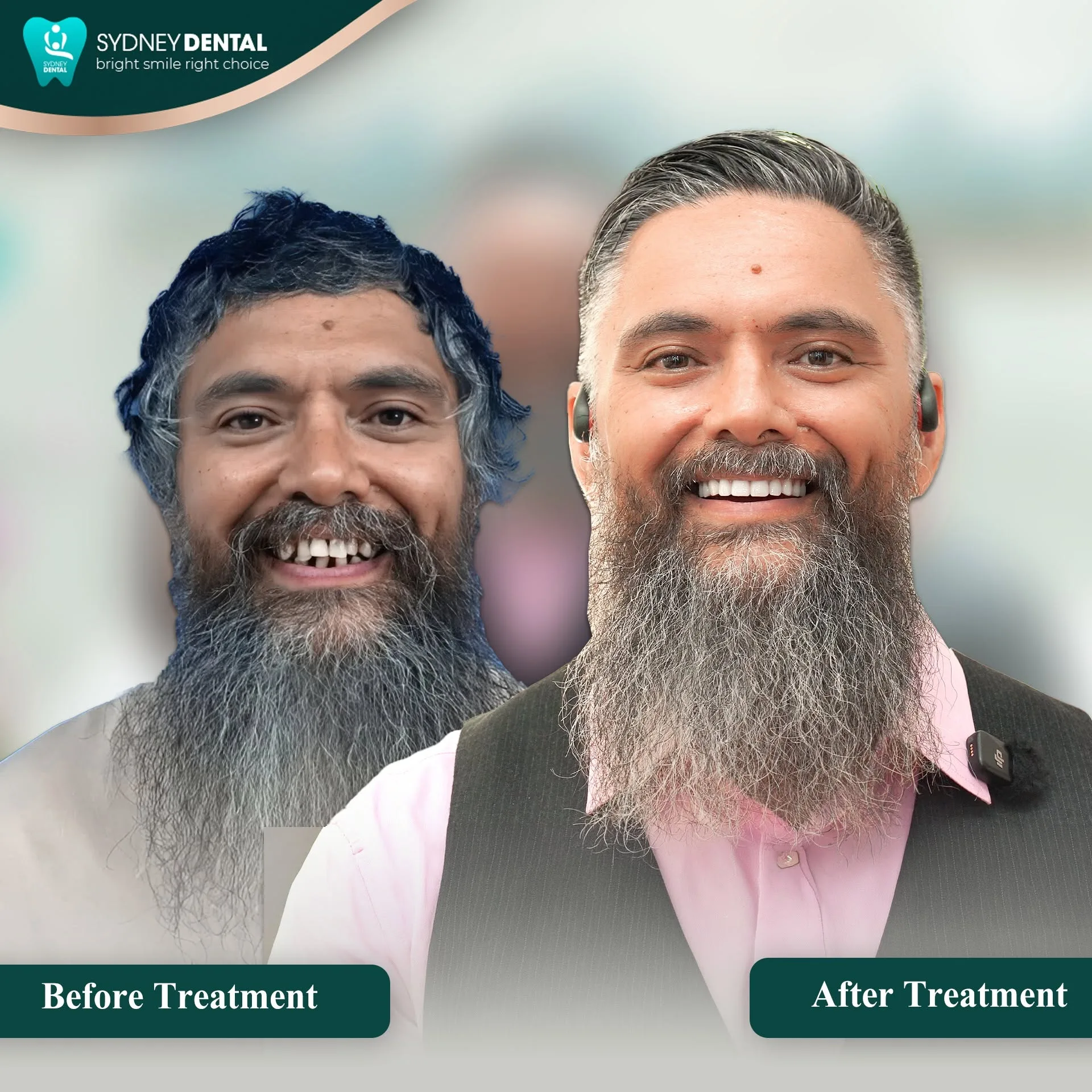 Lesley is finally back, present and confident, reconnecting with his family with a vibrant new smile