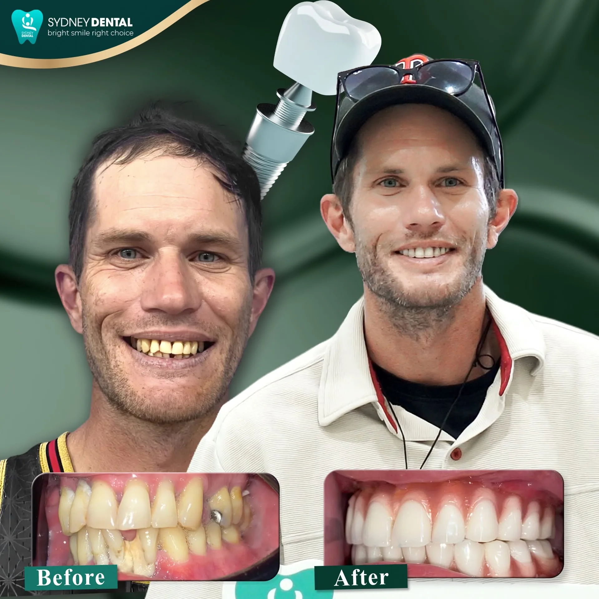 Starting the journey with confidence: Clear communication and a detailed roadmap are the first steps to building trust when traveling abroad for dental care