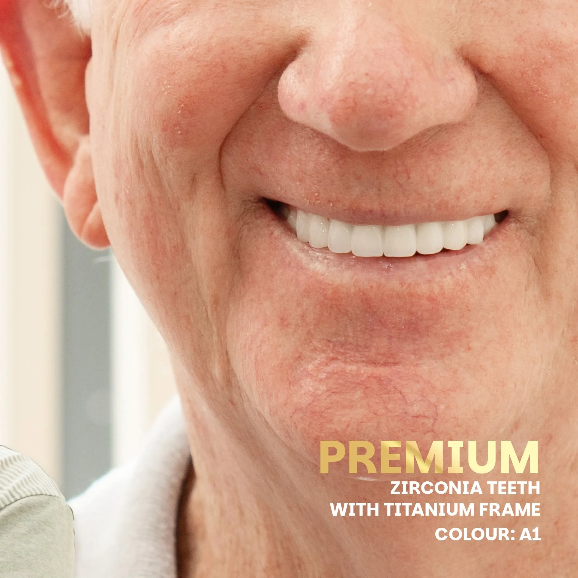 Combining the strength of a custom titanium framework with the lifelike aesthetics of premium Zirconia, crafted right here in our in-house laboratory