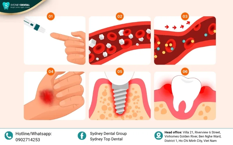 Stable blood sugar levels are the foundation for successful tissue recovery and osseointegration.