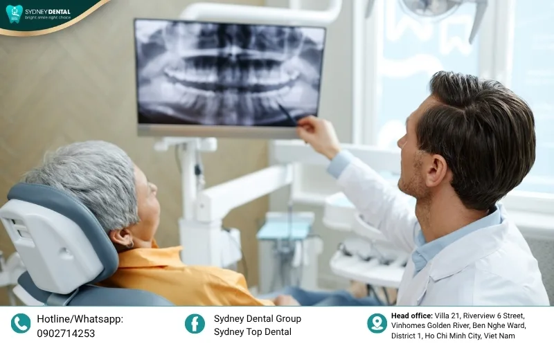 All-on-4 and All-on-6 systems provide a stable and permanent solution for total tooth loss.