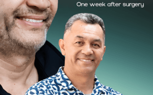 Restoring Confidence: A Complex Full-Mouth Rehabilitation Case Study for Thomas Fox