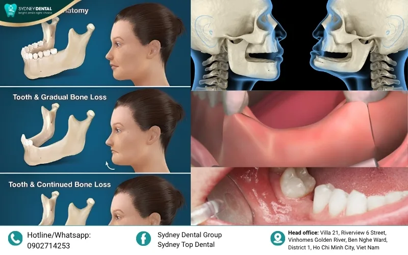Identifying these 5 early warning signs is the first step toward effective dental preservation and long-term health.