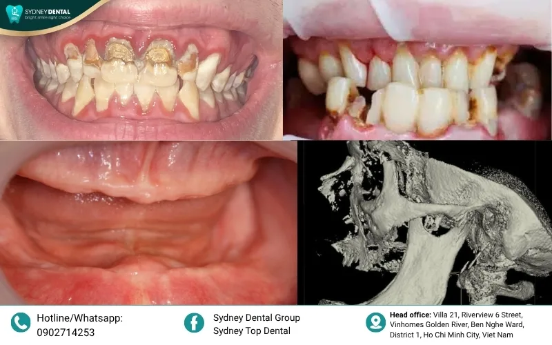 Compromised chewing ability and nutritional limitations.