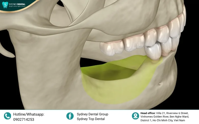 The impact of bone resorption on your jaw structure.