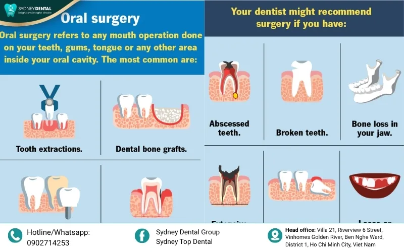 Key factors for successful implant surgery.
