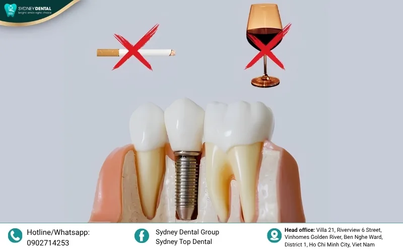 Proper oral hygiene is vital for implant longevity.