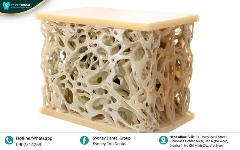 Allografts and xenografts act as a scaffold, allowing the body to regenerate new, healthy bone.