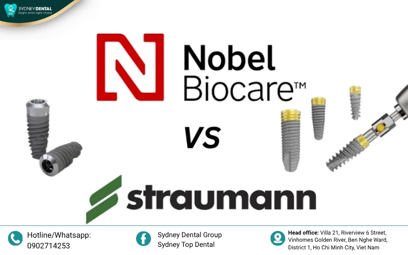 lose-up of premium Swiss Straumann and US Nobel Biocare implant fixtures, known for their supreme success rates in complex cases.