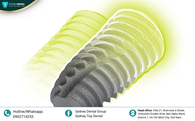 Dentium double-thread implant fixtures providing excellent initial grip and affordable high-quality performance for immediate placement.