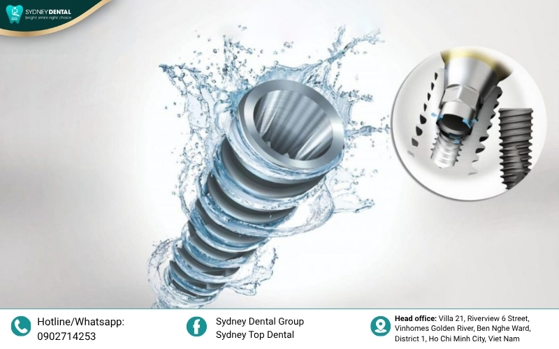 Osstem titanium implant system, widely popular across Asia for its reliable biocompatibility and cost-efficient immediate results.